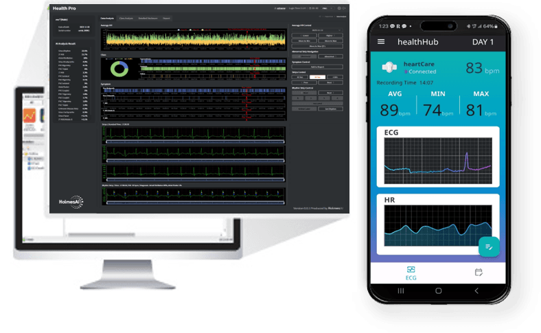 심전도 분석 AI 이미지
